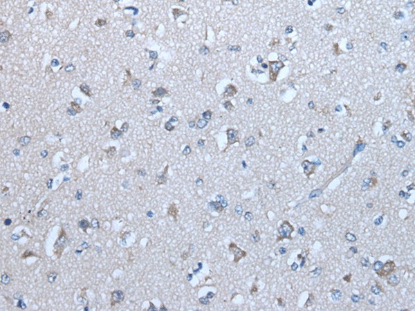 Immunohistochemistry of paraffin-embedded Human brain tissue  using GJA1 Polyclonal Antibody at dilution of 1:50(?200)