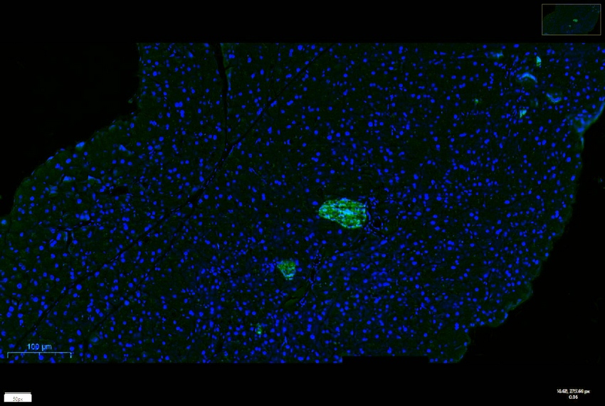 Recombinant Chromogranin A/CHGA/CGA Monoclonal Antibody - small - 8
