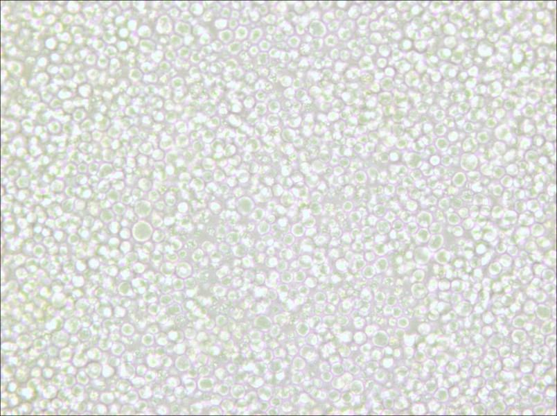 OKT 11 Cell Complete Medium - 6