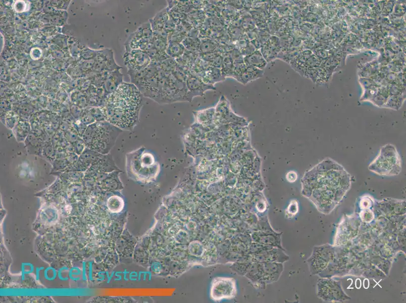 BT-474 [BT474] Cell Complete Medium - small - 5