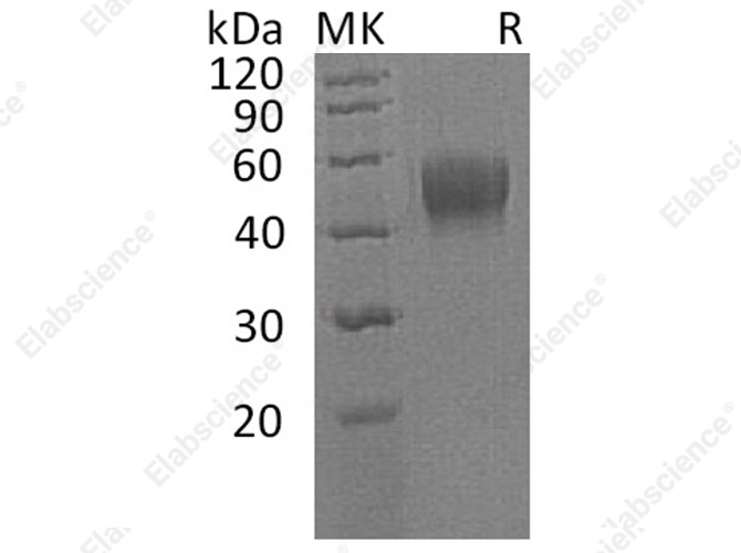 Recombinant Human IL10RB/IL10R2 Protein (His Tag) - 1