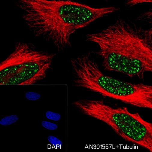 Recombinant SETD1A Monoclonal Antibody - small - 4