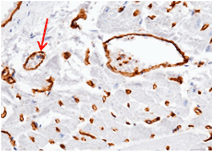 Recombinant ADAM15/MDC15 Monoclonal Antibody - small - 4