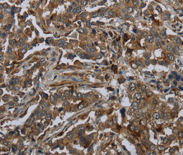 GLUL Polyclonal Antibody - 2