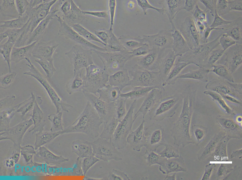 Human Keloid Fibroblast (Primary cell immortalization) Complete MediumHuman Keloid Fibroblast (Primary cell immortalization) Complete Medium - 5