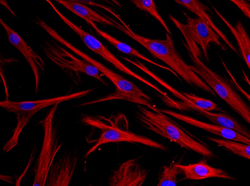 Human Periodontal Ligament Fibroblast Complete Medium - 2