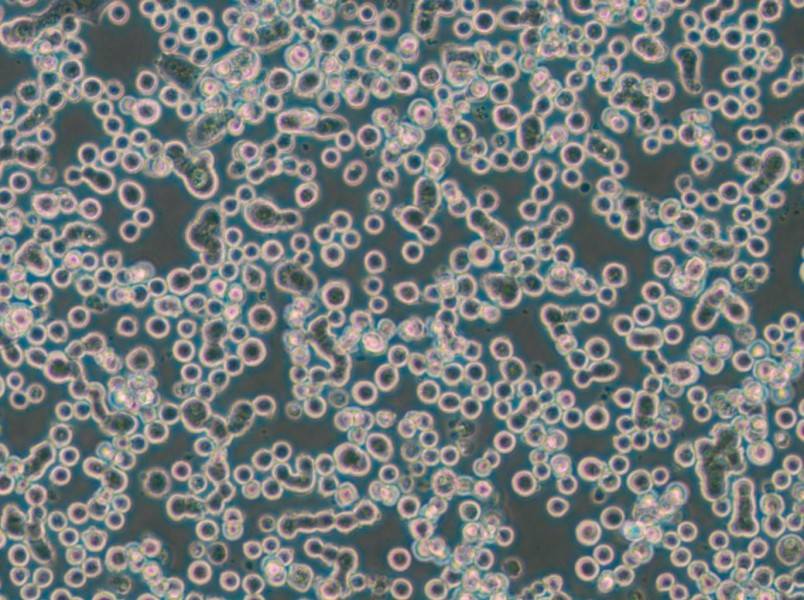 MDA-MB-134-VI (DMEM) Cell Complete Medium - small - 5