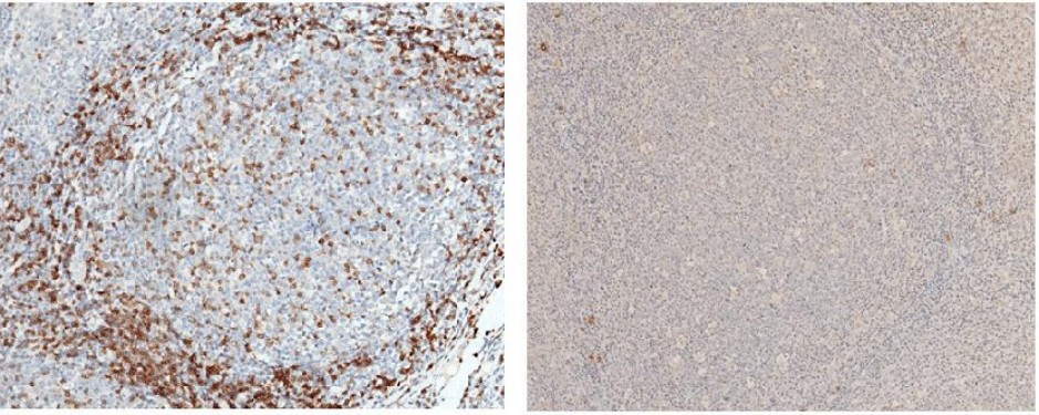CD3d/CD3 delta Monoclonal Antibody - small - 1