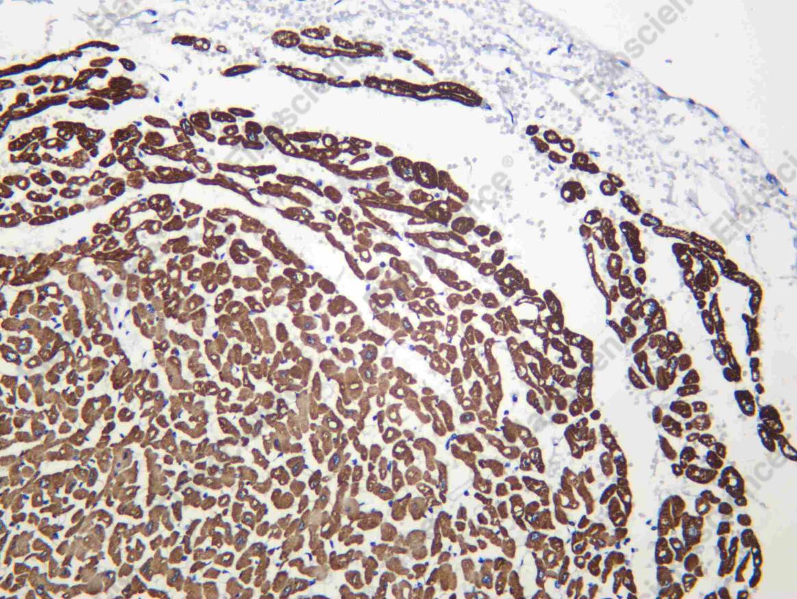 Recombinant MYL3 Monoclonal Antibody - 1