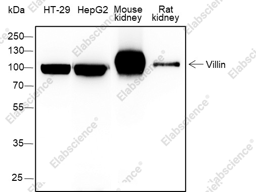 Recombinant Villin Monoclonal Antibody - 1