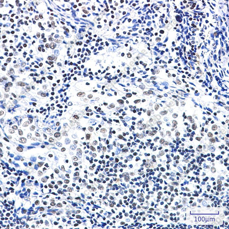 Recombinant ZBTB7A Monoclonal Antibody - 3