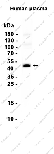 Recombinant TIA1 Monoclonal Antibody - 1