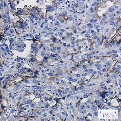 Recombinant ICAM1 Monoclonal Antibody - 2