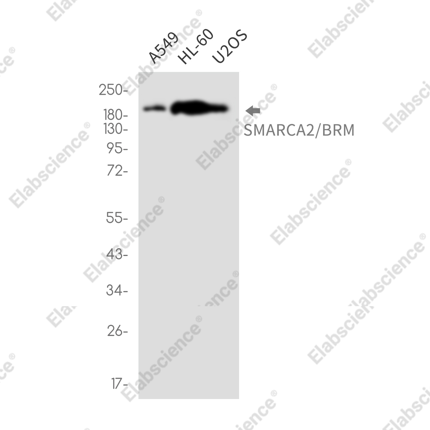Recombinant SMARCA2 Monoclonal Antibody - 1