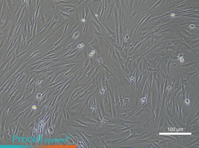 Human Chondrocyte Complete MediumHuman Chondrocyte Complete Medium - 3