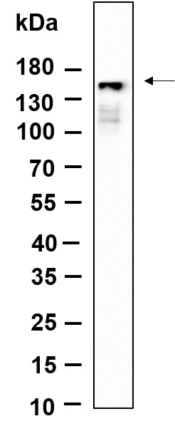 Recombinant Phospho-PLCγ1 (Tyr783) Monoclonal Antibody-searchlist-1