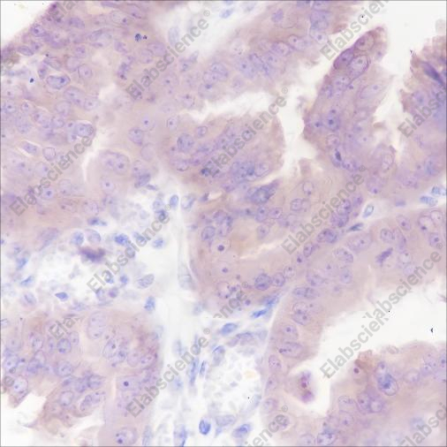 Recombinant RMP/C19orf2 Monoclonal Antibody - 2