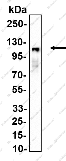 Recombinant DNA Ligase III Monoclonal Antibody - 1