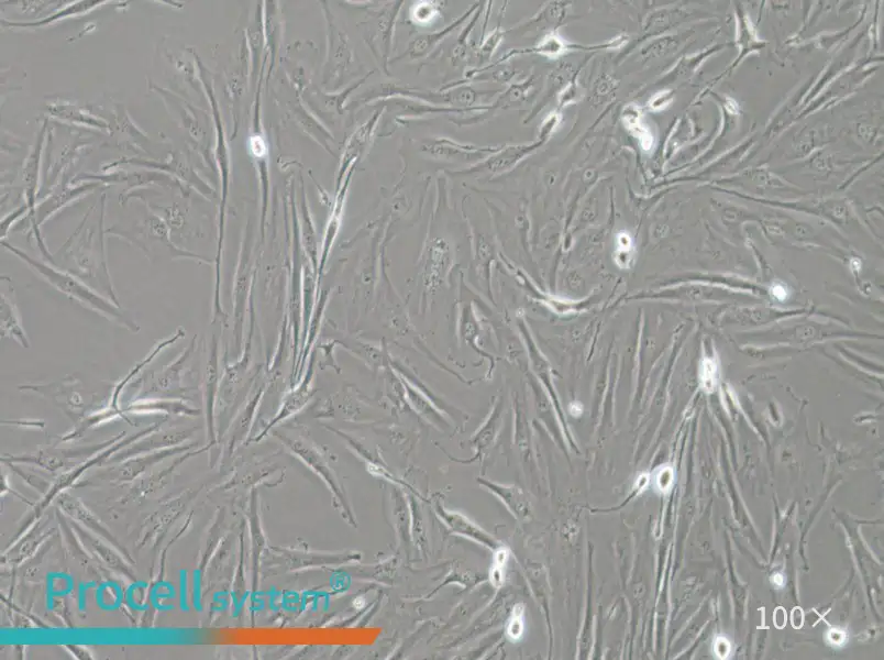 FTC-133 Cell Complete Medium - 2