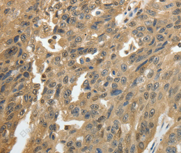 GSR Polyclonal Antibody - 2