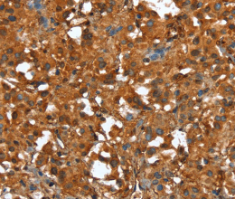 CTBP1 Polyclonal Antibody - 3