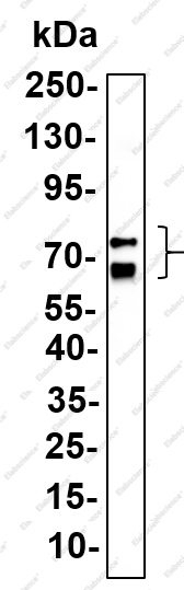 Recombinant PCSK9 Monoclonal Antibody - 1