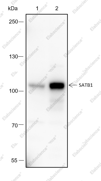 Recombinant SATB1 Monoclonal Antibody - 1