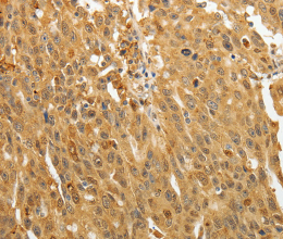 AKR1A1 Polyclonal Antibody - 3