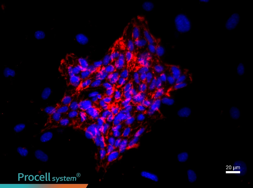 Mouse Cardiac Microvascular Endothelial Cell Complete Medium - 2
