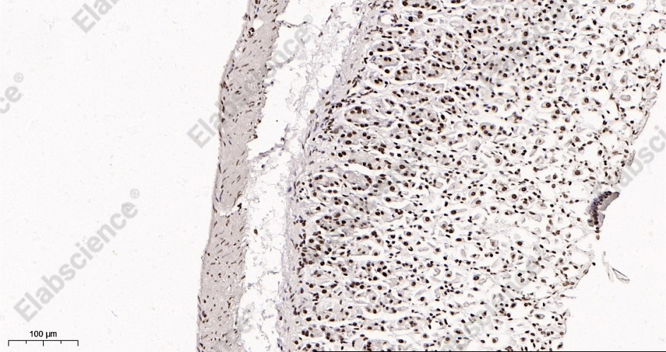 Recombinant Rad21 Monoclonal Antibody - 3