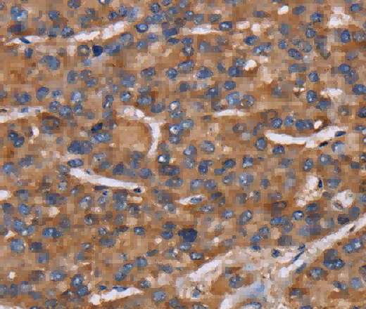 NCSTN Polyclonal Antibody - 2