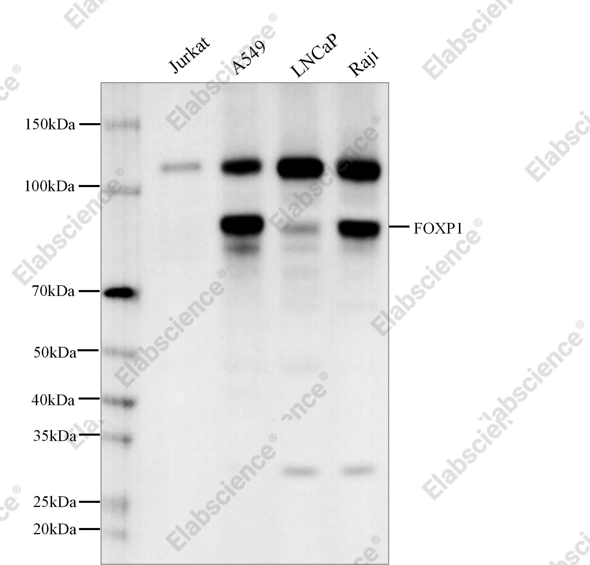 Recombinant FOXP1 Monoclonal Antibody - 1