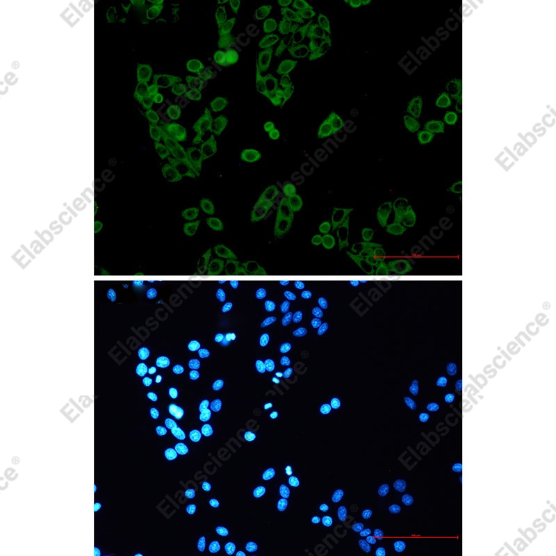 Recombinant RENT1 Monoclonal Antibody - 2