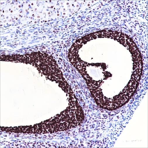 Recombinant FOXL2 Monoclonal Antibody - small - 4