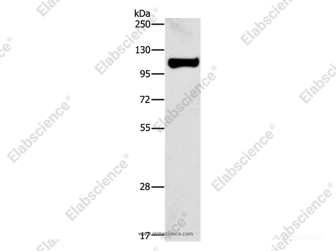 STAT6 Polyclonal Antibody - 1