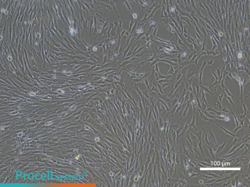 Rat Esophageal Smooth Muscle Cell Complete Medium - 2