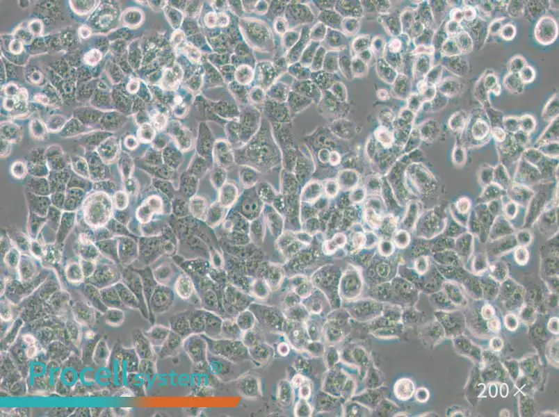 NPC/HK1 Cell Complete Medium - small - 4