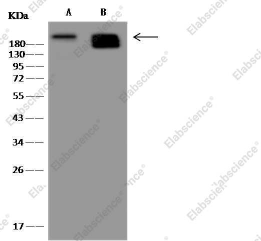 Nestin/NES Monoclonal Antibody - 5