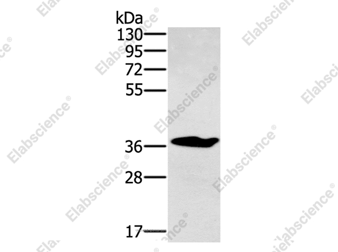 NOV Polyclonal Antibody - 1