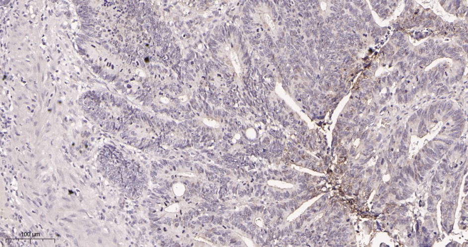 Recombinant Carbonic Anhydrase 9 Monoclonal Antibody - small - 2
