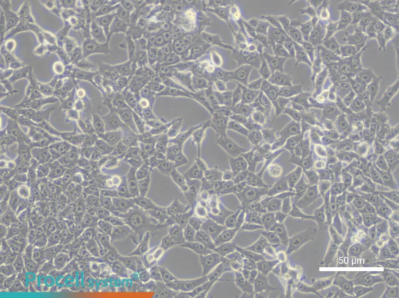 TC-1 [Mouse lung]TC-1 [Mouse lung] - 4