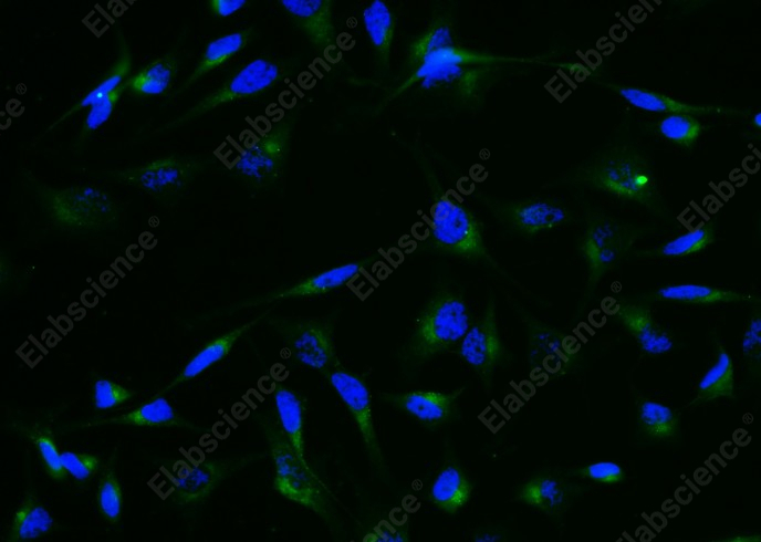 Granulin/GRN/Progranulin Monoclonal Antibody - 1