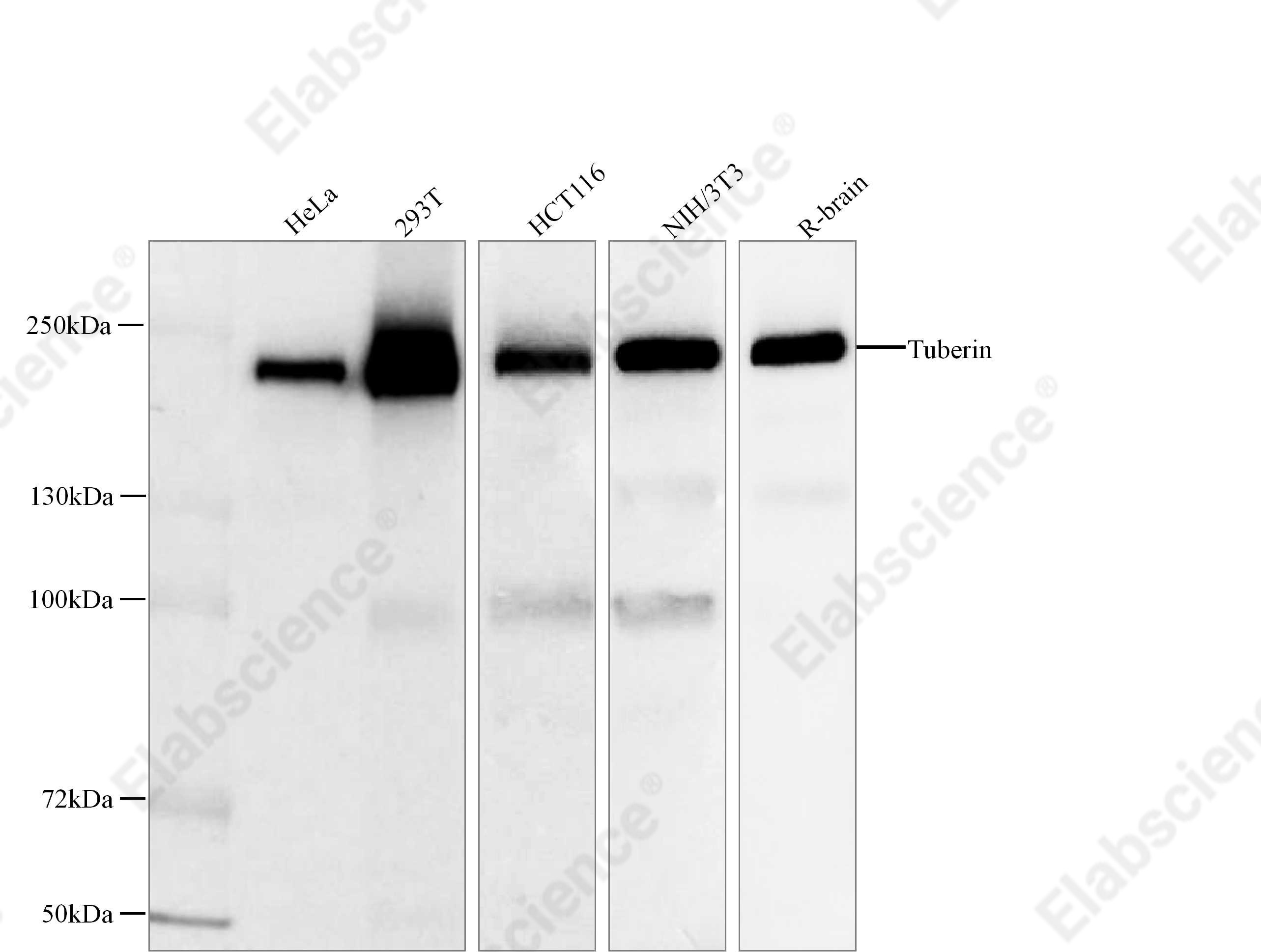 Recombinant Tuberin Monoclonal Antibody - 1