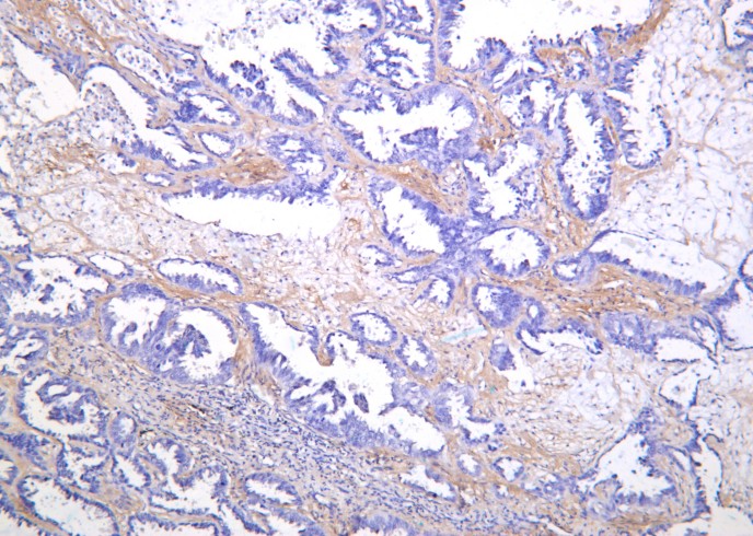 Recombinant SREBP-1 Monoclonal Antibody-searchlist-1