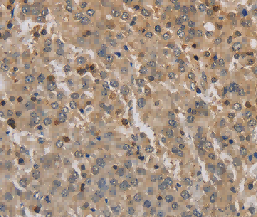 ADO Polyclonal Antibody - 2
