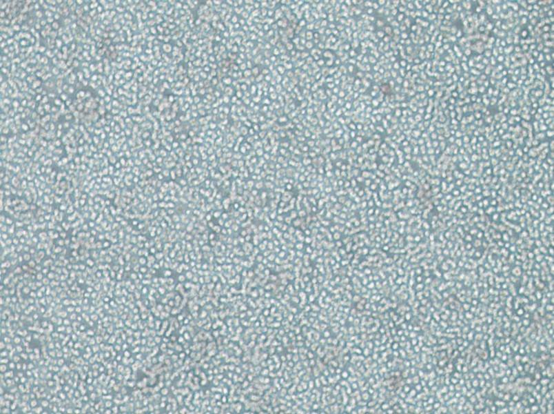 SKNO-1 Cell Complete MediumSKNO-1 Cell Complete Medium - 3