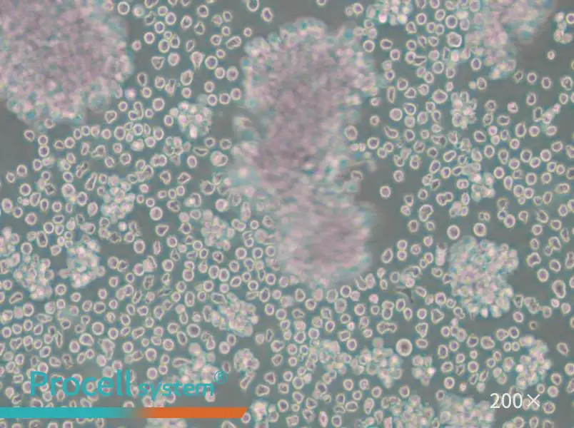 Granta-519 Cell Complete Medium - 5