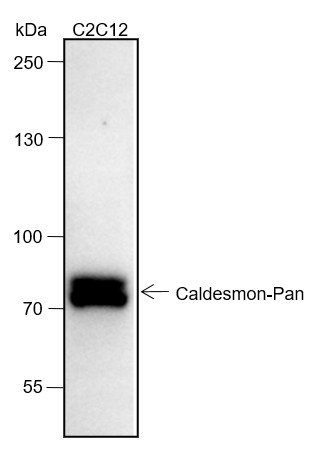 Recombinant Caldesmon/CDM Monoclonal Antibody-searchlist-1