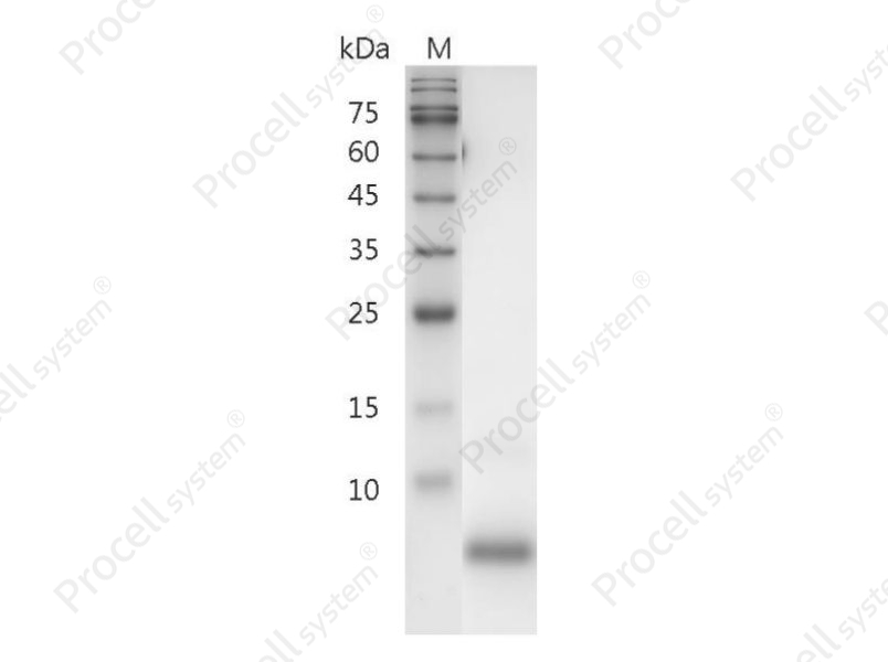 TGF&alpha;/ETGF/TGFA, Human, Recombinant