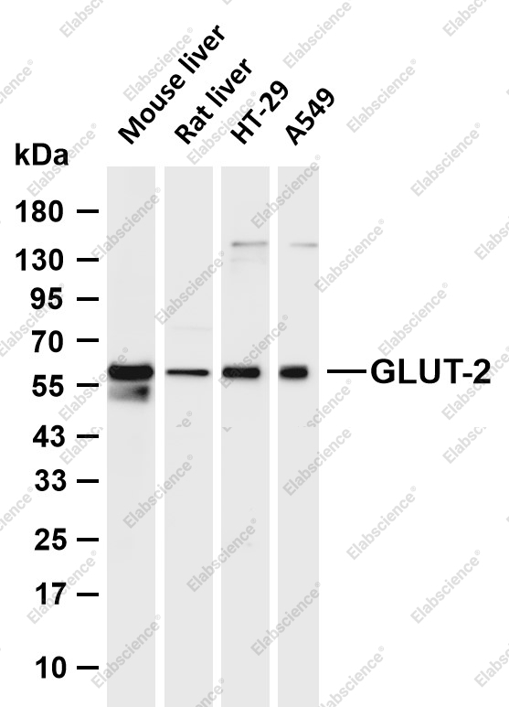 Recombinant GLUT2 Monoclonal Antibody - 1